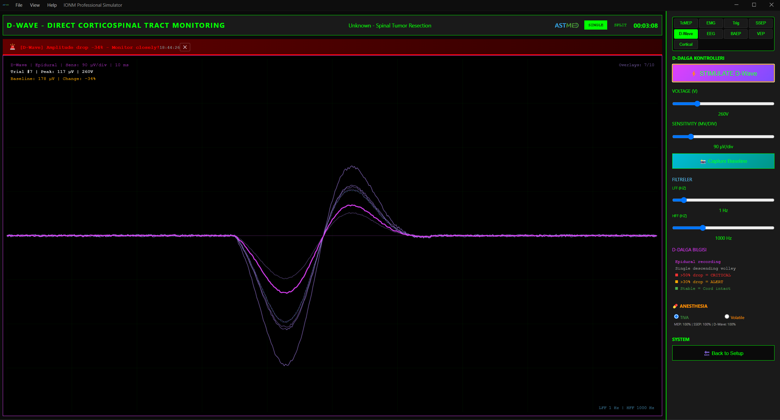 D-Wave Direkt Kortikospinal Yanıt ve Overlay