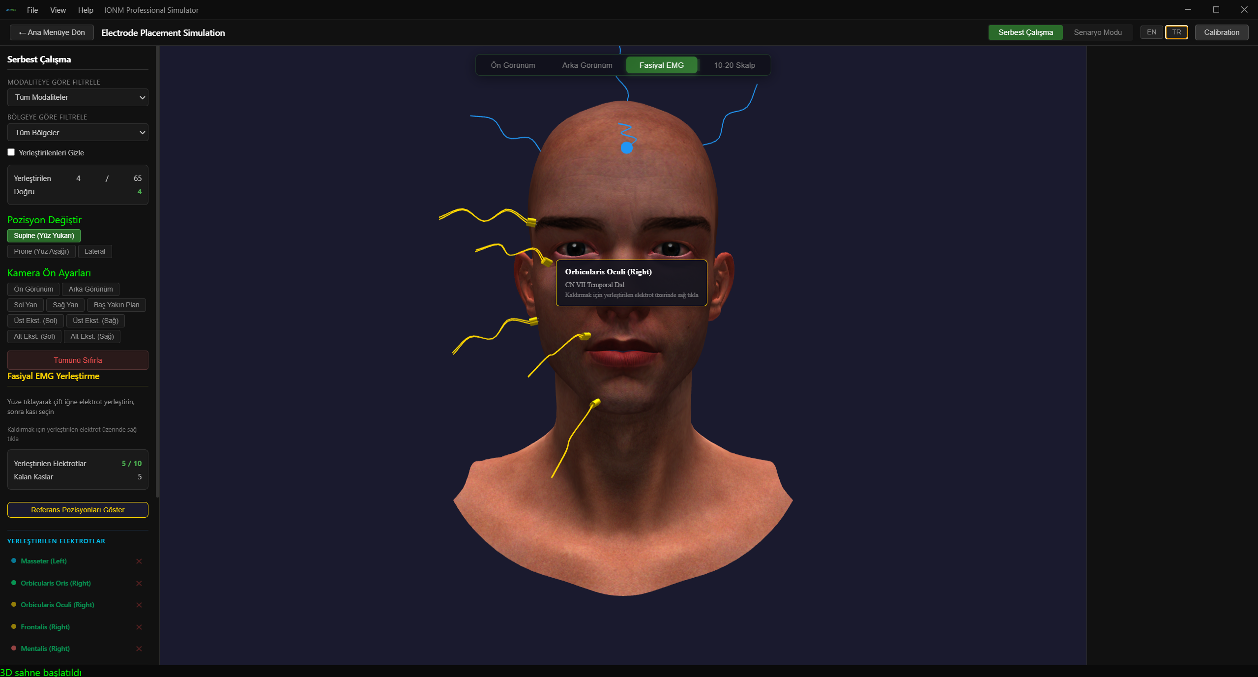 Fasiyal EMG — Kas Seçimi ve Parametreler