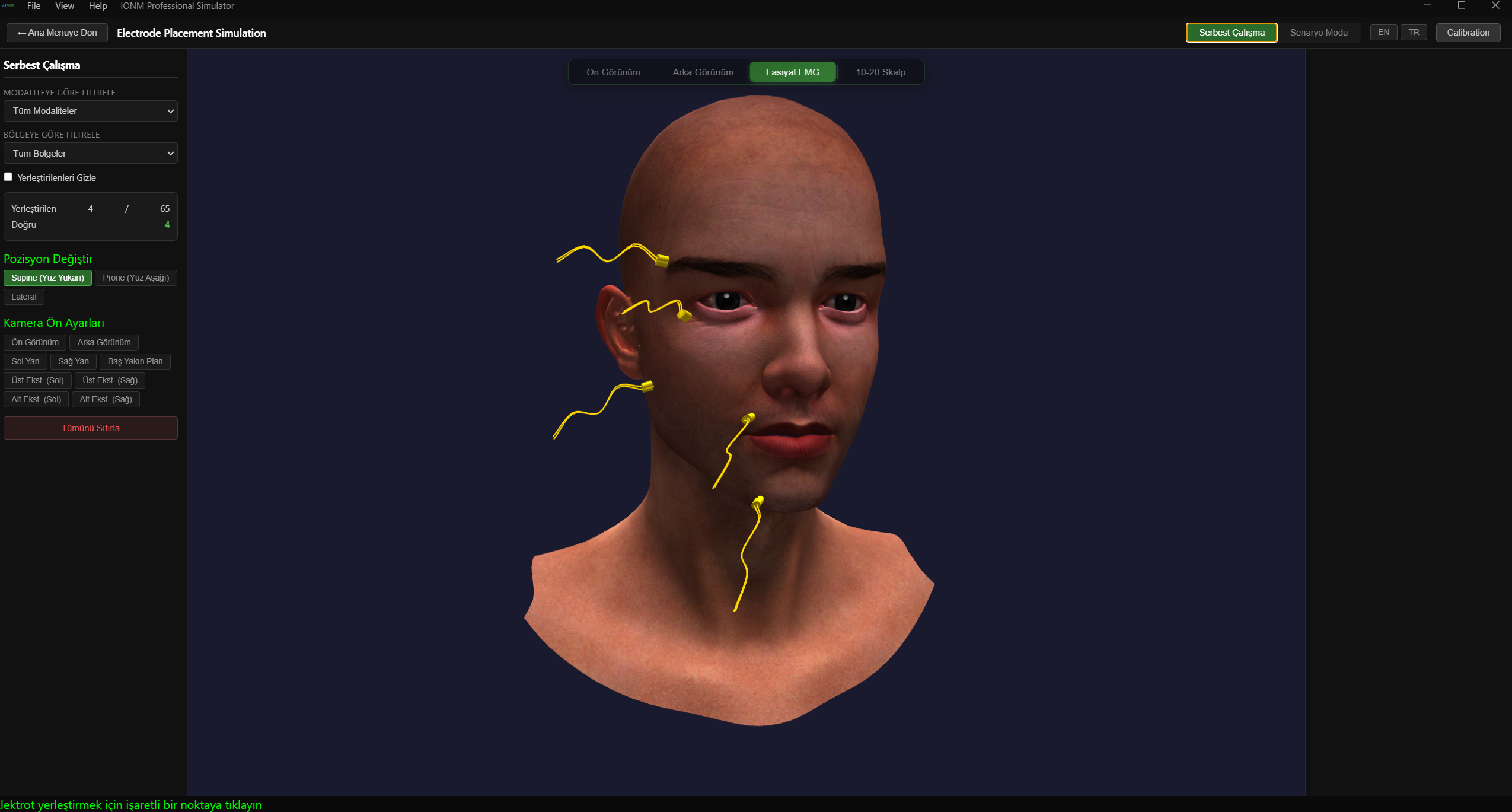 Fasiyal EMG — 3D Yüz Modeli Üzerinde Elektrot Yerleştirme