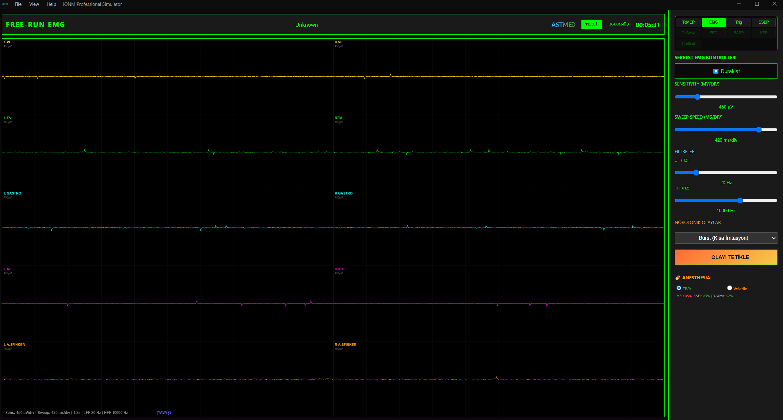 Free-run EMG — 10 Kanallı Spontan Aktivite İzleme Ekranı