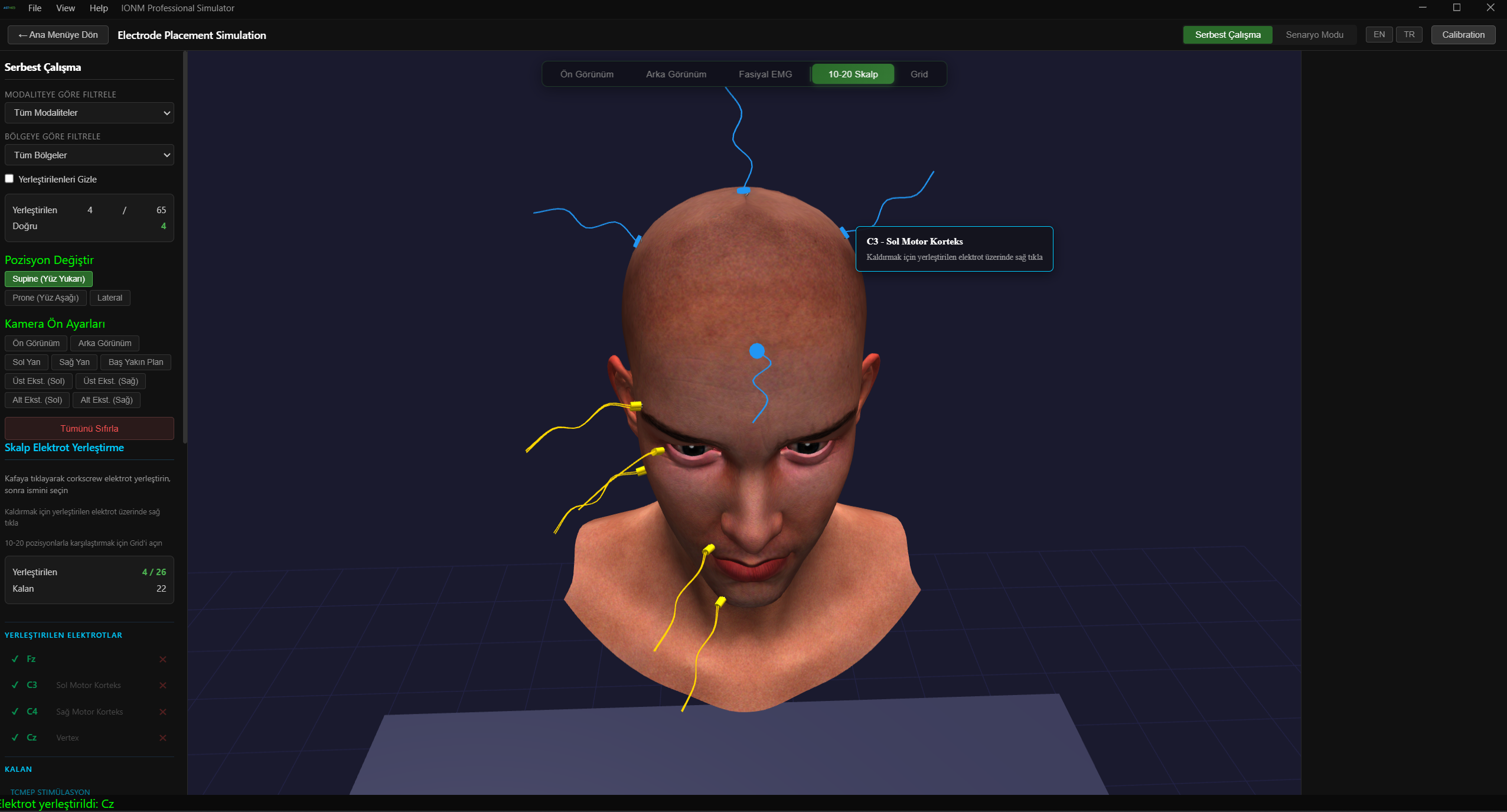 10-20 Sistemi — Elektrot Bilgi Tooltip'i