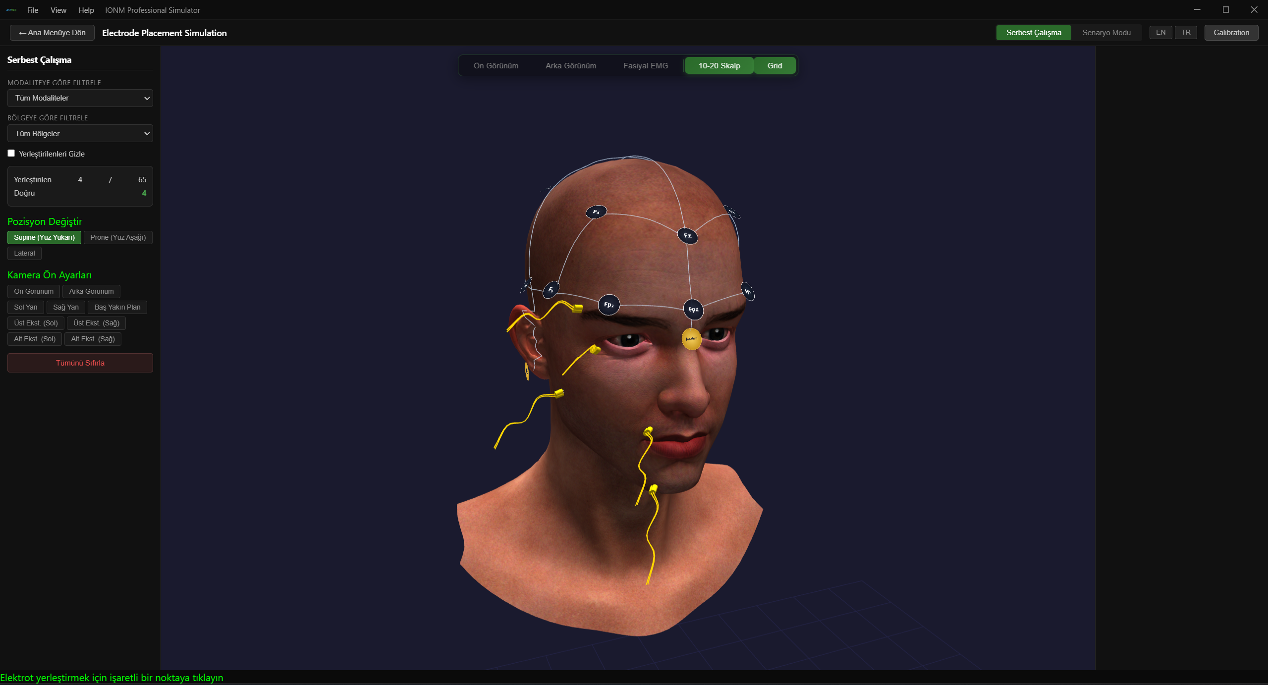 10-20 Sistemi — 3D Kafa Modeli Üzerinde Elektrot Pozisyonları