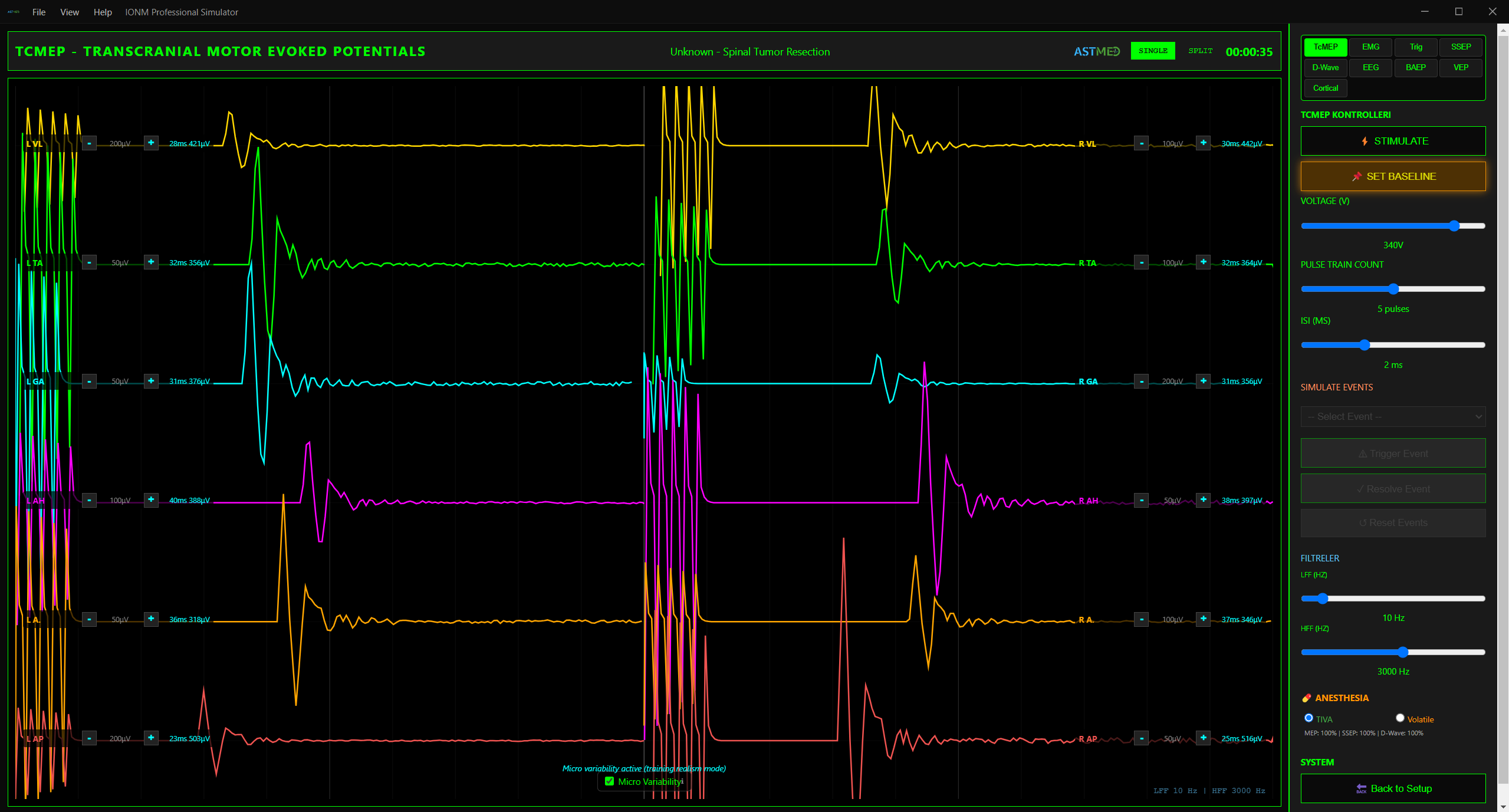 TcMEP Monitorizasyon — Motor Evoke Potansiyel Dalga Formları