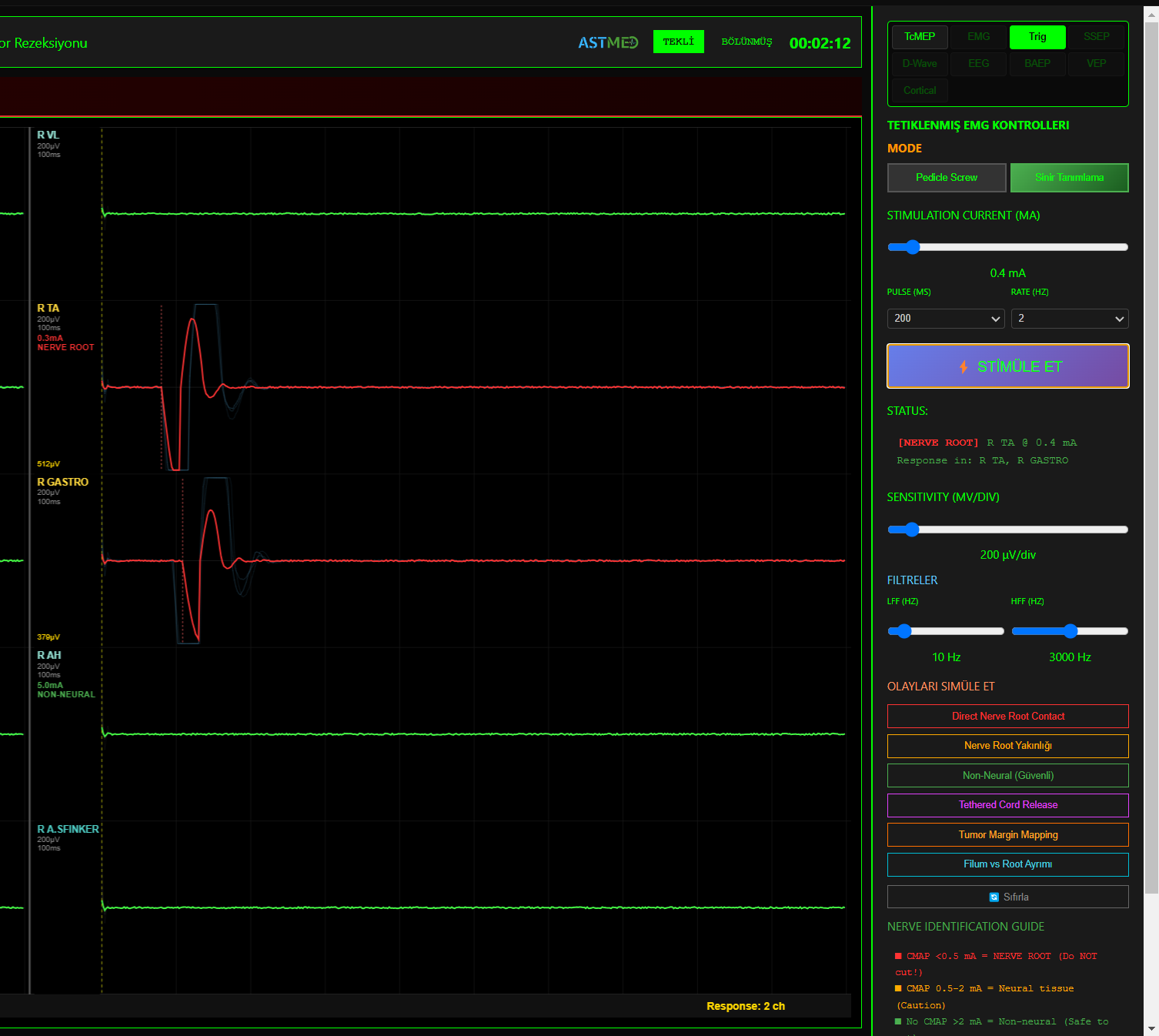 Sinir Tanımlama — Nerve Identification Guide ve CMAP Yanıtı