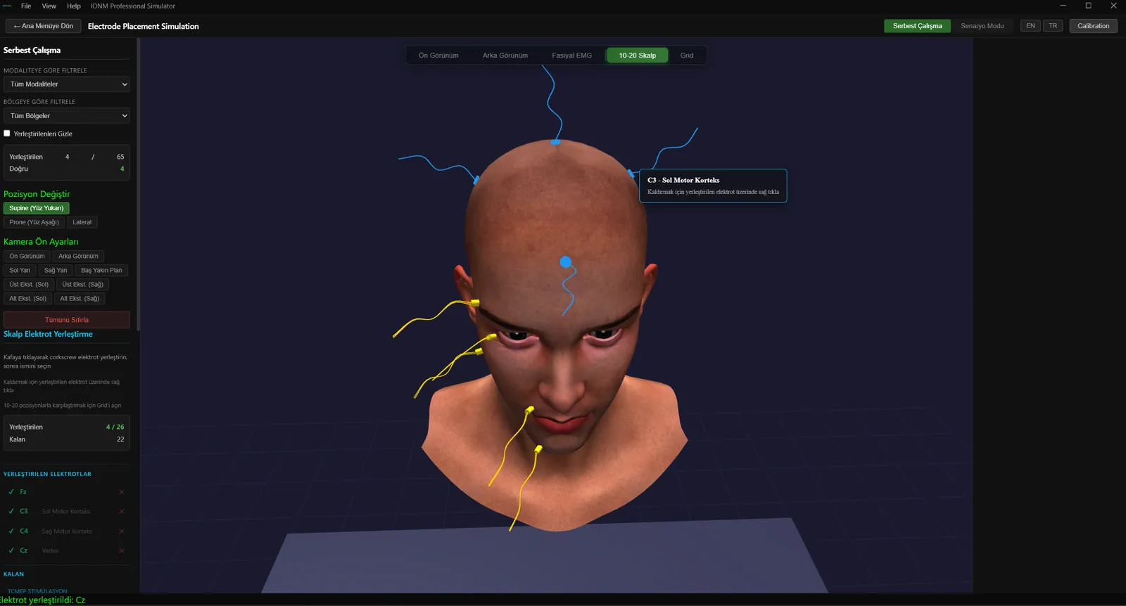 10-20 Sistemi, Elektrot Bilgi Tooltip'i